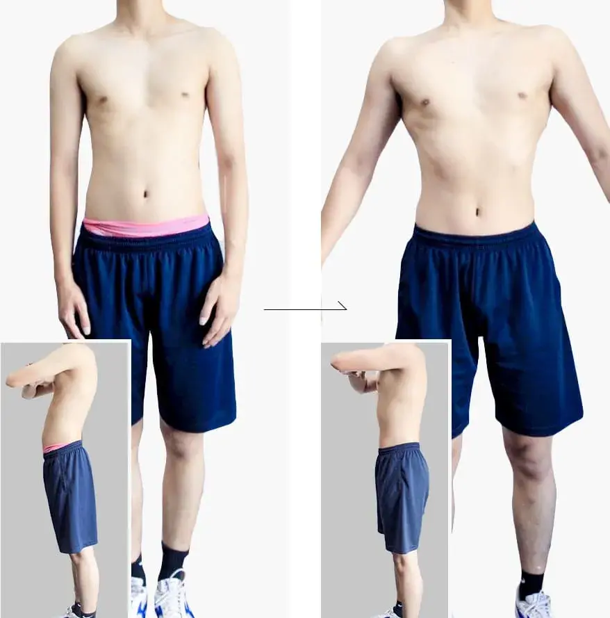 ボディメイク実績 CASE3 筋肉増量＋姿勢改善（18歳 男性）のビフォーアフター